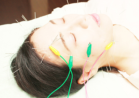 50代、60代～の方におすすめエイジングケア　電気を流す美容鍼