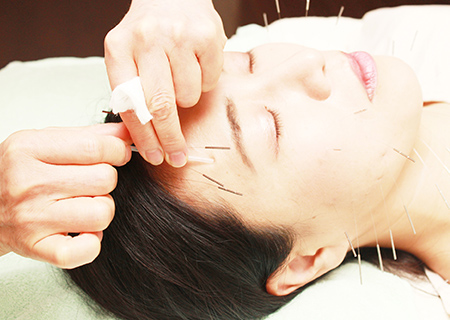 【エイジングケア】シワ/たるみ改善を叶える通常美容鍼　60分