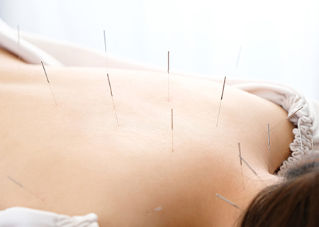 【慢性的な肩こりに】鍼灸施術　60分