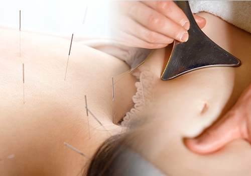 鍼灸で神経に、筋膜リリースで筋肉にアプローチ